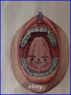 Ancienne Affiche planche anatomique acupuncture médecine chinoise anatomie x 9