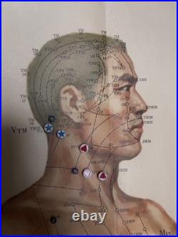 Ancienne Affiche planche anatomique acupuncture médecine chinoise anatomie x 9