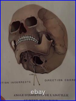 Ancienne Affiche planche anatomique acupuncture médecine chinoise anatomie x 9